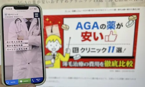 DクリニックのAGA治療