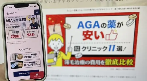 AGAオンクリのAGA治療