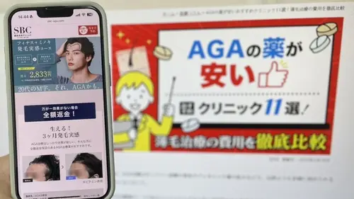 湘南AGAクリニックのAGA治療