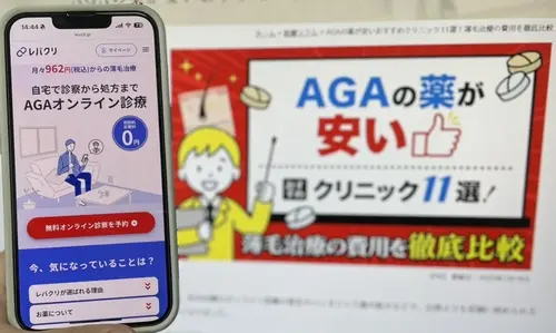 レバクリのAGA治療